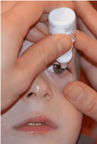 Bild Augentropfen bei Allergien